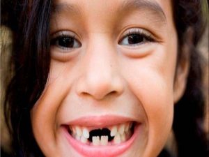 Ngủ mơ rụng răng đánh số đề con gì ? là điềm hên hay xui ?