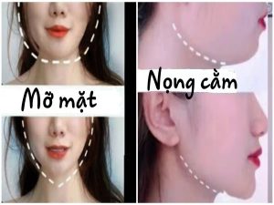 Bài tập giảm mỡ mặt hiệu quả NHANH