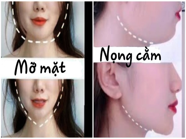 Bài tập giảm mỡ mặt hiệu quả NHANH Bài tập giảm mỡ mặt hiệu quả NHANH